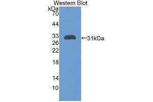 Detection of Recombinant GP39, Rat using Polyclonal Antibody to Chitinase-3-like Protein 1 (CHI3L1) (CHI3L1 抗体  (AA 117-364))