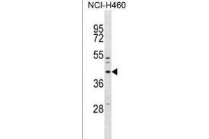 MFF Antibody (Center) (ABIN1537829 and ABIN2838250) western blot analysis in NCI- cell line lysates (35 μg/lane). (MFF 抗体  (AA 133-162))