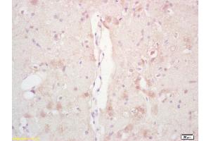 Formalin-fixed and paraffin embedded rat brain labeled with Rabbit Anti Phospho-Acetyl CoA Carboxylase(Ser79) /ACACA Polyclonal Antibody, Unconjugated (ABIN1386220) at 1:200 followed by conjugation to the secondary antibody and DAB staining (Acetyl-CoA Carboxylase 抗体  (pSer79))