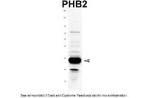 WB Suggested Anti-PHB2 Antibody Titration: 1 ug/mlPositive Control: Rat tissue (Prohibitin 2 抗体  (C-Term))