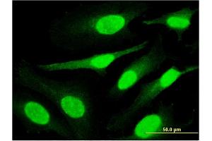 Immunofluorescence of monoclonal antibody to PPHLN1 on HeLa cell. (PPHLN1 抗体  (AA 168-258))
