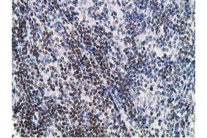 Image no. 1 for anti-Deoxycytidine Kinase (DCK) antibody (ABIN1497773) (DCK 抗体)
