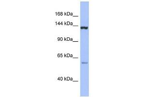 DHX34 antibody used at 1 ug/ml to detect target protein. (DHX34 抗体)