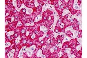 Human Liver: Formalin-Fixed, Paraffin-Embedded (FFPE) (DAAM2 抗体  (AA 68-97))