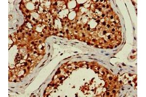 Immunohistochemistry of paraffin-embedded human testis tissue using ABIN7158320 at dilution of 1:100 (LHFPL5 抗体  (AA 46-99))