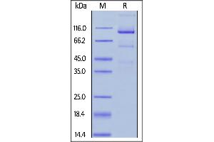 SDS-PAGE (SDS) image for Glypican 3 (GPC3) (AA 25-559) protein (Fc Tag,FITC) (ABIN6253194)