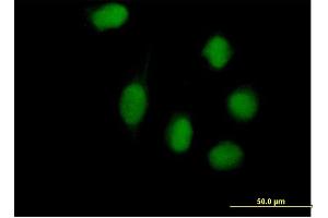 Immunofluorescence of purified MaxPab antibody to WHSC1L1 on HeLa cell. (WHSC1L1 抗体  (AA 1-645))