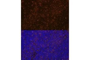 Immunofluorescence (IF) image for anti-Wiskott-Aldrich Syndrome (Eczema-thrombocytopenia) (WAS) antibody (ABIN7271381)