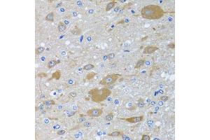 Immunohistochemistry of paraffin-embedded rat brain using EIF2S3 antibody (ABIN5975415) at dilution of 1/100 (40x lens). (EIF2S3 抗体)