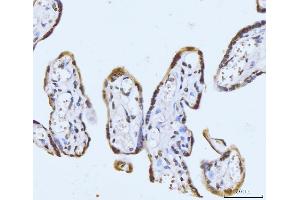 IHC analysis of GHITM using anti-GHITM antibody (ABIN7599294).