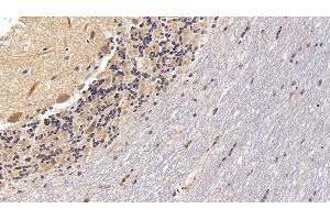 Detection of VDAC1 in Human Cerebellum Tissue using Monoclonal Antibody to Voltage Dependent Anion Channel Protein 1 (VDAC1)