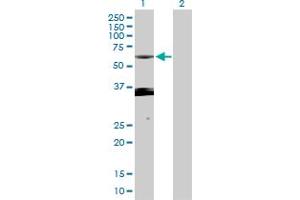 Western Blot analysis of PXK expression in transfected 293T cell line by PXK MaxPab polyclonal antibody. (PXK 抗体  (AA 1-450))