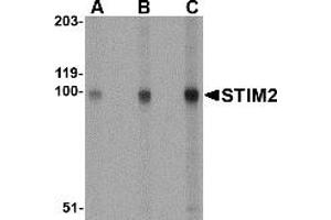 Western Blotting (WB) image for anti-Stromal Interaction Molecule 2 (Stim2) (Middle Region) antibody (ABIN1031110) (Stim2 抗体  (Middle Region))
