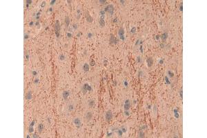 Used in DAB staining on fromalin fixed paraffin- embedded brain tissue (INPP4A 抗体  (AA 1-137))