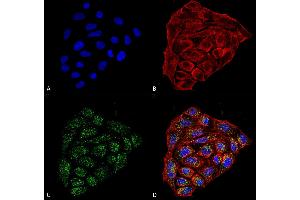 Immunocytochemistry/Immunofluorescence analysis using Mouse Anti-CD74 Monoclonal Antibody, Clone 1B8 .