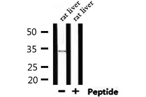 Western blot analysis of extracts from rat liver, using MyD88 Antibody. (MYD88 抗体)