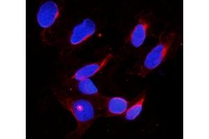 IF analysis of DDX4 using anti-DDX4 antibody (ABIN7601203). (DDX4 抗体  (AA 3-666))