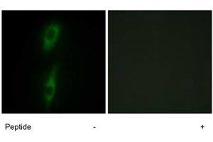Immunofluorescence analysis of HeLa cells, using ACVRL1 polyclonal antibody . (ACVRL1 抗体)