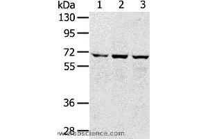 Western blot analysis of 293T, hepg2 and A172 cell, using SLC5A9 Polyclonal Antibody at dilution of 1:300 (SLC5A9 抗体)