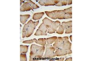 Formalin-fixed and paraffin-embedded human skeletal muscle reacted with T150A Antibody (Center), which was peroxidase-conjugated to the secondary antibody, followed by DAB staining. (TMEM150A 抗体  (Middle Region))