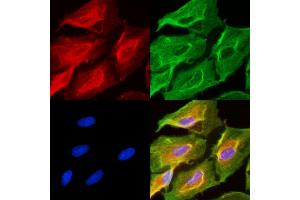 ABIN6256988 and ABIN6275146 staining  cells(UV treatment) by IF/ICC.
