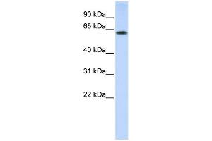 WB Suggested Anti-TRIM55 Antibody Titration:  0. (TRIM55 抗体  (N-Term))