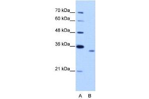 WB Suggested Anti-RBM4B  Antibody Titration: 2. (RBM4B 抗体  (C-Term))