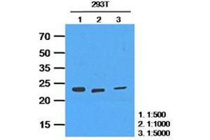 Western Blotting (WB) image for anti-Hypoxanthine phosphoribosyltransferase 1 (HPRT1) antibody (ABIN781535) (HPRT1 抗体)