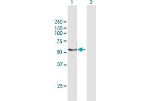 Western Blot analysis of CYP4F22 expression in transfected 293T cell line by CYP4F22 MaxPab polyclonal antibody.