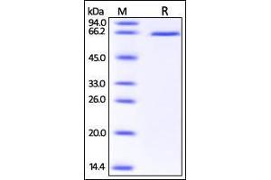 Human DLL1, His Tag on SDS-PAGE under reducing (R) condition. (DLL1 Protein (AA 18-540) (His tag))