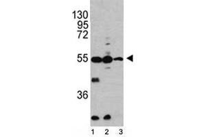 Western blot analysis of Caspase-2 antibody and 1) HL-60, 2) K562, 3) Ramos lysate. (Caspase 2 抗体  (AA 198-226))