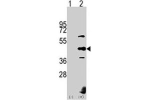 Western blot analysis of PDK2 (arrow) using PDK2 polyclonal antibody . (PDK2 抗体  (AA 378-407))