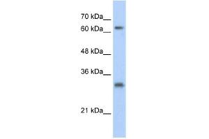WB Suggested Anti-USP39 Antibody Titration:  0. (USP39 抗体  (N-Term))