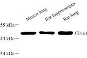 Western blot analysis of Clavesin 1 (ABIN7073517) at dilution of 1: 1000,Lane 1: Mouse lung tissue lysate,Lane 2: Rat ppocampus tissue lysate,Lane 3: Rat lung tissue lysate (Clavesin 1 抗体)