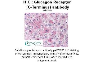 Image no. 1 for anti-Glucagon Receptor (GCGR) (C-Term) antibody (ABIN1734752) (Glucagon Receptor 抗体  (C-Term))