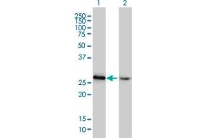 Western Blot analysis of HMGB2 expression in transfected 293T cell line by HMGB2 monoclonal antibody (M02), clone 4G7. (HMGB2 抗体  (AA 1-195))