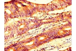 Immunohistochemistry (IHC) image for anti-Ubiquitin Specific Peptidase 4 (USP4) (AA 632-810) antibody (ABIN7174328)