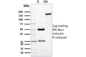 SDS-PAGE Analysis Purified AKT1 Mouse Monoclonal Antibody (AKT1/2552).