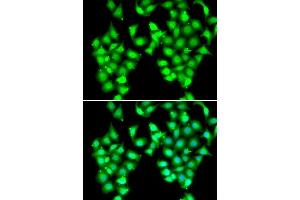 Immunofluorescence analysis of MCF7 cells using ATOH1 antibody. (ATOH1 抗体  (AA 215-354))