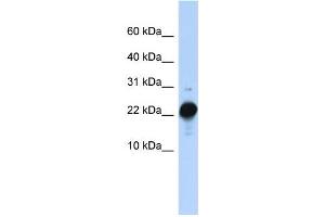 WB Suggested Anti-CSHL1 Antibody Titration:  0.