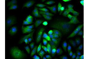 Image provided by One World Lab validation program. (XIAP 抗体  (AA 201-330))
