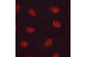 ABIN6268643 staining MCF-7 cells by ICC/IF. (FOSB 抗体)