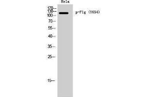 Western Blotting (WB) image for anti-Filaggrin (FLG) (pTyr654) antibody (ABIN3182416) (Filaggrin 抗体  (pTyr654))