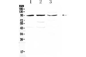 Western blot analysis of CD105 using anti- CD105 antibody . (Endoglin 抗体  (Middle Region))