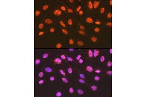 Immunofluorescence analysis of C6 cells using ENT2/SLC29 Rabbit mAb (ABIN7270448) at dilution of 1:100 (40x lens). (SLC29A2 抗体)