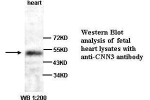 Image no. 1 for anti-Calponin 3, Acidic (CNN3) (C-Term) antibody (ABIN790991) (CNN3 抗体  (C-Term))