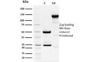 SDS-PAGE Analysis Purified HPV-18 Mouse Monoclonal Antibody (HPV16 E1/E4). (Human Papilloma Virus 16 E1, E4 (HPV-16 E1, E4) (AA 36-41) 抗体)