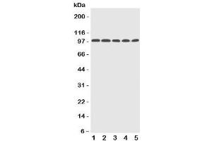 Western blot testing of Progesterone Receptor antibody and Lane 1: human HeLa (Progesterone Receptor 抗体  (AA 595-933))