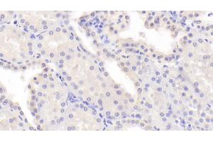 Detection of PDCD6 in Human Kidney Tissue using Polyclonal Antibody to Programmed Cell Death Protein 6 (PDCD6) (PDCD6 抗体  (AA 32-191))