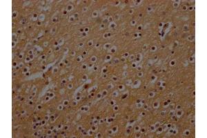IHC image of ABIN7161274 diluted at 1:300 and staining in paraffin-embedded human brain tissue performed on a Leica BondTM system. (NEFH 抗体  (AA 825-1003))